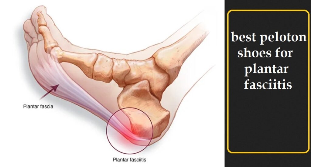 Best Peloton Shoes to Prevent Plantar Fasciitis Cycling Inspire